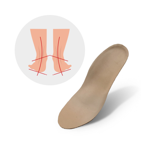 Overpronatie thumpnail