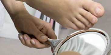 Diabetische voet Diabetische voet